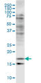 Cofilin 2 antibody, LS-C133115, Lifespan Biosciences, Western Blot image 