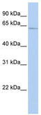 SRY-Box 30 antibody, TA332018, Origene, Western Blot image 