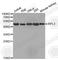 Ribosomal Protein L3 antibody, A4082, ABclonal Technology, Western Blot image 