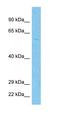 Transmembrane Serine Protease 2 antibody, orb325283, Biorbyt, Western Blot image 