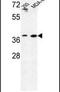 Methionine Adenosyltransferase 2B antibody, PA5-26542, Invitrogen Antibodies, Western Blot image 