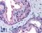 Aryl Hydrocarbon Receptor antibody, LS-C140973, Lifespan Biosciences, Immunohistochemistry paraffin image 