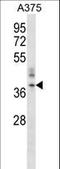 Calcium release-activated calcium channel protein 1 antibody, LS-C163264, Lifespan Biosciences, Western Blot image 