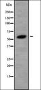 Leucine Rich Repeat And Sterile Alpha Motif Containing 1 antibody, orb338276, Biorbyt, Western Blot image 