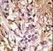 Microtubule Associated Protein 1 Light Chain 3 Beta antibody, LS-C165706, Lifespan Biosciences, Immunohistochemistry frozen image 