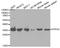 Protein Phosphatase 4 Catalytic Subunit antibody, STJ25096, St John