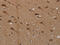 Phosphodiesterase 5A antibody, CSB-PA126186, Cusabio, Immunohistochemistry paraffin image 