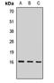 Eukaryotic Translation Initiation Factor 1A X-Linked antibody, LS-C668679, Lifespan Biosciences, Western Blot image 