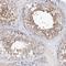 KIAA1109 antibody, HPA038076, Atlas Antibodies, Immunohistochemistry frozen image 