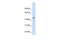 Cytochrome P450 Family 3 Subfamily A Member 7 antibody, GTX47116, GeneTex, Western Blot image 