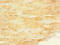 Protein Phosphatase 1 Regulatory Subunit 3A antibody, LS-C676301, Lifespan Biosciences, Immunohistochemistry paraffin image 