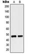 Neutrophil Cytosolic Factor 1 antibody, orb215429, Biorbyt, Western Blot image 