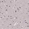 Inositol Polyphosphate-4-Phosphatase Type I A antibody, NBP1-92023, Novus Biologicals, Immunohistochemistry paraffin image 