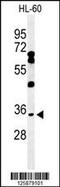 Basic Helix-Loop-Helix Family Member E22 antibody, 61-659, ProSci, Western Blot image 