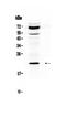 Angiopoietin Like 8 antibody, A02471, Boster Biological Technology, Western Blot image 