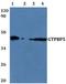 Mitochondrial Ribosome Associated GTPase 2 antibody, A11583, Boster Biological Technology, Western Blot image 