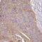 Matrix Metallopeptidase 1 antibody, FNab05233, FineTest, Immunohistochemistry frozen image 
