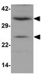 CXXC Finger Protein 5 antibody, GTX31997, GeneTex, Western Blot image 