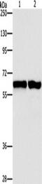 Asparagine Synthetase (Glutamine-Hydrolyzing) antibody, TA349668, Origene, Western Blot image 