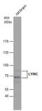 Metadherin antibody, GTX100587, GeneTex, Western Blot image 