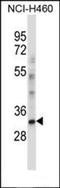 HECT, C2 And WW Domain Containing E3 Ubiquitin Protein Ligase 2 antibody, orb224112, Biorbyt, Western Blot image 