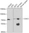 CXXC Finger Protein 1 antibody, 19-875, ProSci, Western Blot image 