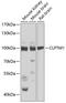 CLPTM1 Regulator Of GABA Type A Receptor Forward Trafficking antibody, A08423-1, Boster Biological Technology, Western Blot image 