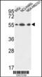 ATP synthase subunit alpha, mitochondrial antibody, 64-109, ProSci, Western Blot image 