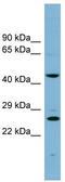 VPS28 Subunit Of ESCRT-I antibody, TA345056, Origene, Western Blot image 