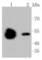 Tubulin Beta 4B Class IVb antibody, NBP2-67520, Novus Biologicals, Western Blot image 