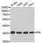 Prolactin antibody, STJ25144, St John