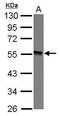 Glycosyltransferase Like Domain Containing 1 antibody, GTX121445, GeneTex, Western Blot image 