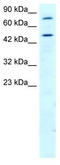 Regulator Of G Protein Signaling 9 antibody, TA330404, Origene, Western Blot image 