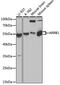 Arrestin Beta 1 antibody, 13-363, ProSci, Western Blot image 