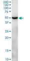 C-Type Lectin Domain Containing 14A antibody, H00161198-B01P, Novus Biologicals, Western Blot image 