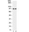 Aryl Hydrocarbon Receptor antibody, R32060, NSJ Bioreagents, Western Blot image 