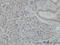 Nuclear Factor Kappa B Subunit 1 antibody, LS-C133346, Lifespan Biosciences, Immunohistochemistry paraffin image 