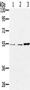 Sestrin-2 antibody, TA351659, Origene, Western Blot image 
