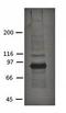 Plakophilin 2 antibody, orb76775, Biorbyt, Western Blot image 