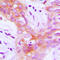 Insulin Like Growth Factor 1 Receptor antibody, LS-C354275, Lifespan Biosciences, Immunohistochemistry frozen image 