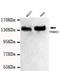 Tripartite Motif Containing 33 antibody, LS-C178320, Lifespan Biosciences, Western Blot image 