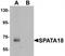 Spermatogenesis Associated 18 antibody, TA320103, Origene, Western Blot image 