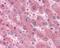 Serum amyloid A protein antibody, 49-782, ProSci, Immunohistochemistry paraffin image 