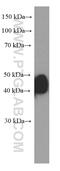 Estrogen Receptor 2 antibody, 60197-1-Ig, Proteintech Group, Western Blot image 