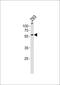 Zinc Finger Protein 76 antibody, PA5-35269, Invitrogen Antibodies, Western Blot image 