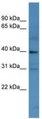 MAGE Family Member C2 antibody, TA342769, Origene, Western Blot image 