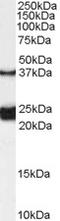 Galanin Receptor 1 antibody, LS-C54897, Lifespan Biosciences, Western Blot image 