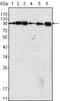 Dynamin 1 antibody, A02536-1, Boster Biological Technology, Western Blot image 