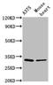 Translocase Of Inner Mitochondrial Membrane Domain Containing 1 antibody, CSB-PA885685LA01HU, Cusabio, Western Blot image 