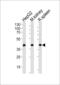 Acyl-CoA Dehydrogenase Long Chain antibody, 56-871, ProSci, Western Blot image 